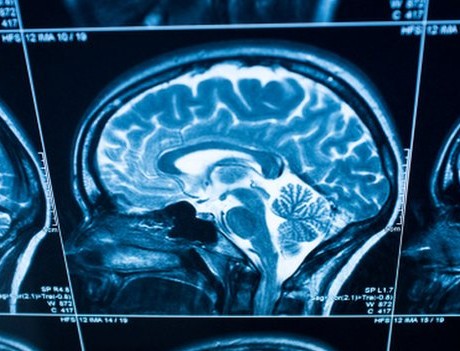 _77254081_brain_mri